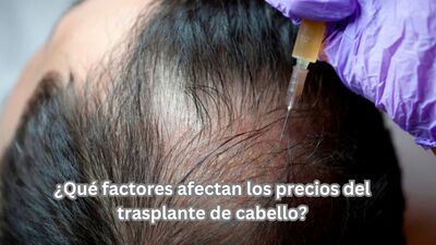 ¿Qué factores afectan los precios del trasplante de cabello?